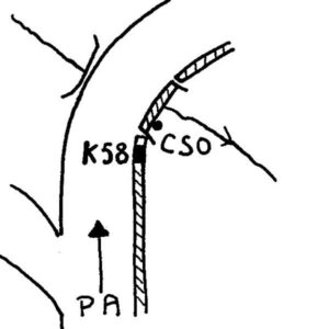 0092#_###_070# - BIVIO FURNARI - Ponte al km 58,002 della SS. n 113