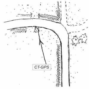 043630 - CANTON BARBERO