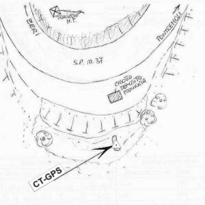 084603 - BIVIO CODOLO