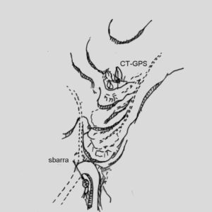 096909 - PASSO DEL VESTITO