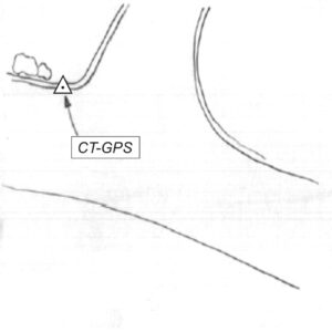 102613 - MARGHERIA DEI BOSCHI